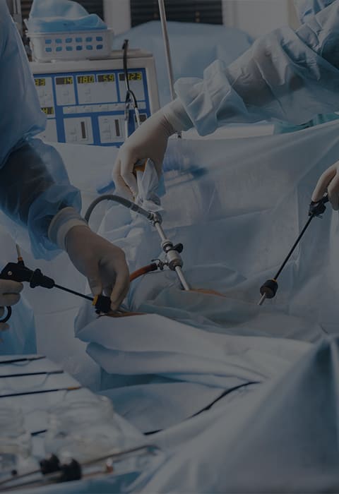 Cirugía y cirugía laparoscópica (mínima invasión)